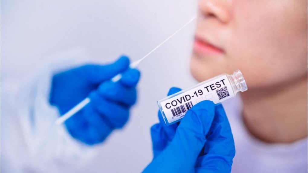 Ha a kórházi kezelés előtt PCR-tesztre van szükségünk, azt a létesítménynek kell biztosítania