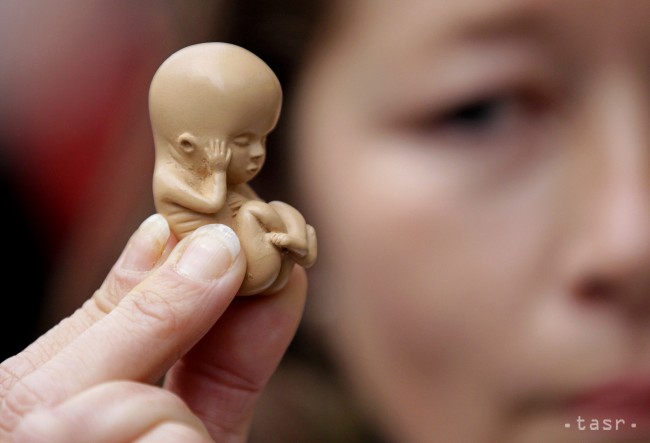 A magyar kormány a szívhang meghallgatásához köti a terhesség művi megszakítását
