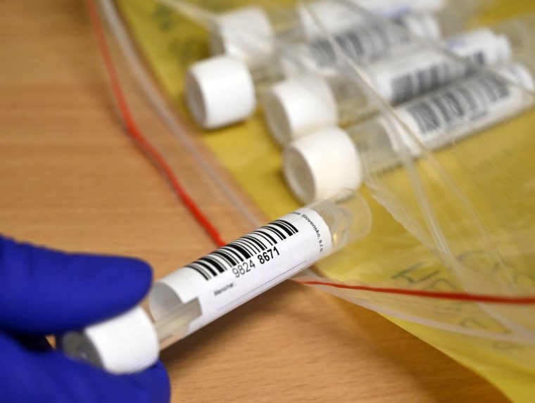 Szerdán 571 új koronavírus fertőzöttet regisztráltak