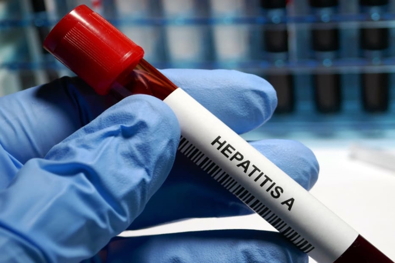 Eperjes higiénikusai három új hepatitis A típusú megbetegedést regisztráltak