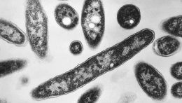 A kassai TEHO hőgazdálkodási vállalat mintákat vesz Legionella előfordulásának gyanúja miatt
