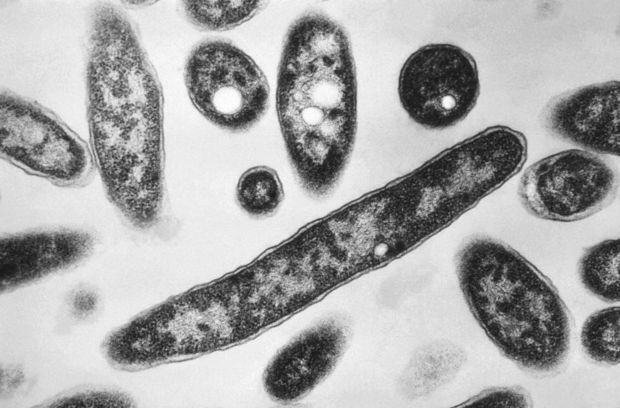 A kassai TEHO hőgazdálkodási vállalat mintákat vesz Legionella előfordulásának gyanúja miatt